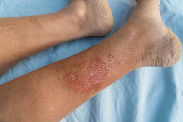 Dalili za Damu Chafu Mwilini: Jinsi ya Kutambua na Kusafisha Kiasili