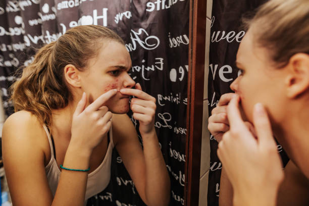 Dalili za Hormonal Imbalance: Mabadiliko ya Homoni na Tiba Yake