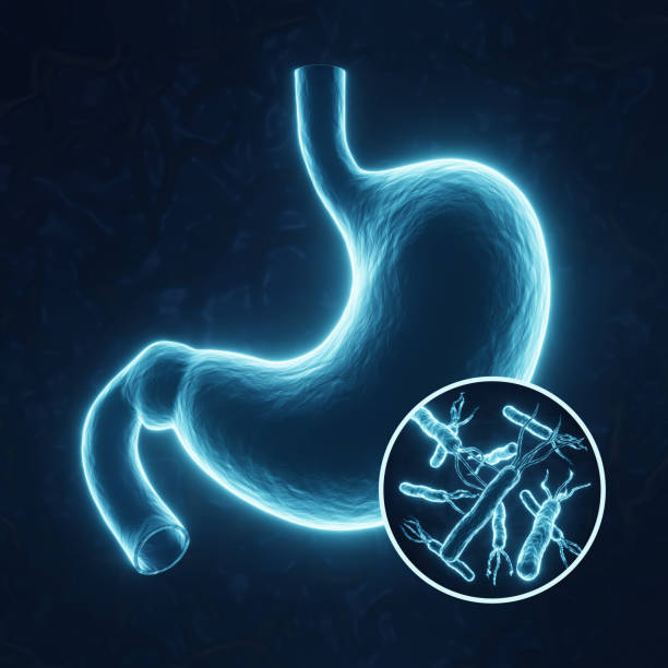 Dalili Za H Pylori Mwilini: Sababu, Madhara Na Jinsi Ya Kutibu Haraka