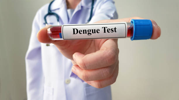 Homa Ya Dengue Ni Nini? Dalili, Sababu, Matibabu Na Kinga Sahihi