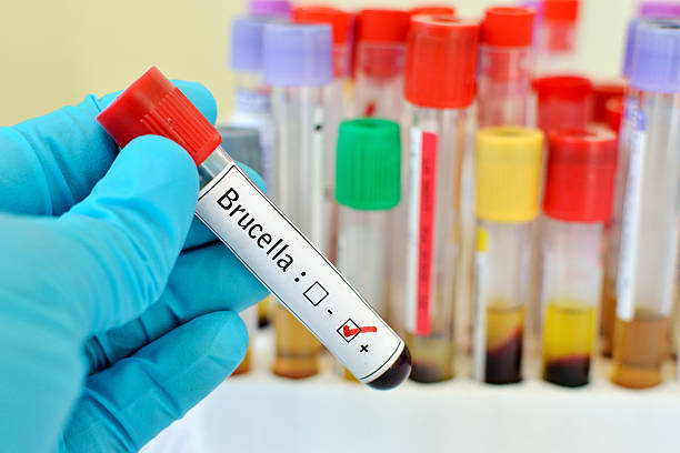 Ishara Muhimu za Ugonjwa wa Brucellosis na Jinsi ya Kuukabili